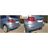 Aragon Vertically Detachable Towbar for Mercedes B CLASS 2005 to 2011